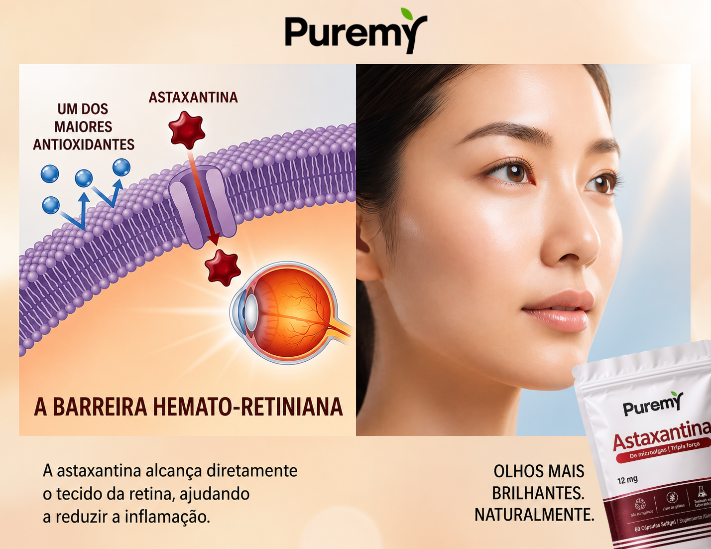 Olhos sem olheiras